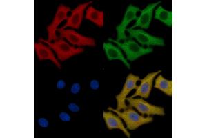 AQP2 Mouse Monoclonal Antibody staining HepG2 cells by IF/ICC. (AQP2 抗体  (C-Term))
