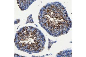 IHC analysis of SEC23IP using anti-SEC23IP antibody (ABIN7601222).