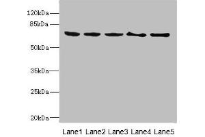 Western blot All lanes: PLK3 antibody at 1. (PLK3 抗体  (AA 487-646))