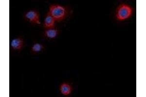 Immunofluorescent analysis of Syntaxin 1A (pS14) staining in NIH3T3 cells. (STX1A 抗体  (N-Term, pSer14))