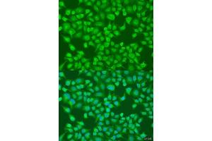 Immunohistochemistry of paraffin-embedded human liver using  Rabbit pAb (ABIN6131168, ABIN6136442, ABIN6136443 and ABIN6224114) at dilution of 1:25 (40x lens). (ACOX1 抗体  (AA 1-270))