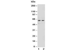 Western blot testing of NOX1 antibody and Lane 1:  HeLa (NOX1 抗体  (AA 354-374))