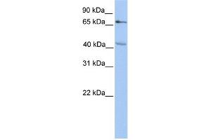 CHST13 antibody used at 1 ug/ml to detect target protein. (CHST13 抗体)