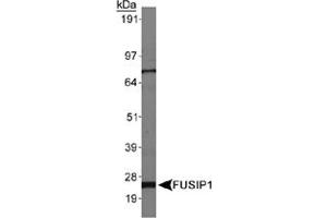 Western blot analysis of FUSIP1, isoform 3, in HepG2 whole cell lysates using FUSIP1 polyclonal antibody . (SRSF10 抗体  (AA 100-200))