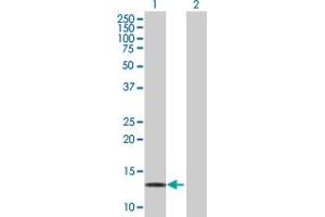 Western Blot analysis of LDOC1 expression in transfected 293T cell line by LDOC1 MaxPab polyclonal antibody. (LDOC1 抗体  (AA 1-146))