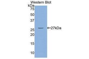 Western Blotting (WB) image for anti-Myosin Light Chain Kinase (MYLK) (AA 1661-1877) antibody (ABIN1859947) (MYLK 抗体  (AA 1661-1877))