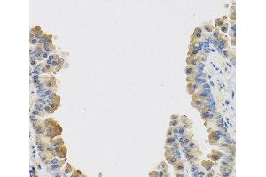 Immunohistochemistry (Paraffin-embedded Sections) (IHC (p)) image for anti-Interleukin 25 (IL25) antibody (ABIN7264293)