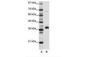Image no. 1 for anti-Heterogeneous Nuclear Ribonucleoprotein D-Like (HNRPDL) (AA 119-168) antibody (ABIN203083) (HNRPDL 抗体  (AA 119-168))