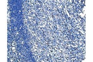 IHC analysis of HSPA6 using anti-HSPA6 antibody (ABIN7601944).