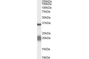 Western Blotting (WB) image for anti-Arginase, Liver (ARG1) (AA 316-330) antibody (ABIN295463) (Liver Arginase 抗体  (AA 316-330))