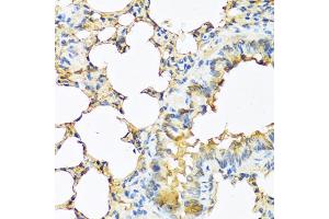 Immunohistochemistry of paraffin-embedded mouse lung using TSHB antibody (ABIN5974108) at dilution of 1/100 (40x lens). (TSHB 抗体)
