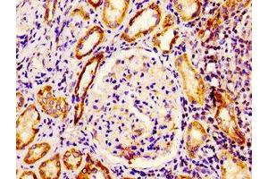 Immunohistochemistry (IHC) image for anti-Epidermal Growth Factor Receptor Pathway Substrate 8 (EPS8) (AA 572-670) antibody (ABIN7151882)
