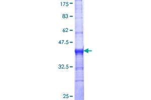 SLC18A2 Protein (AA 53-151) (GST tag)