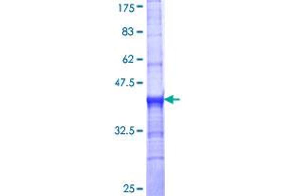 SLC18A2 Protein (AA 53-151) (GST tag)