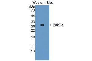 Western blot analysis of recombinant Human ALT. (ALT 抗体  (AA 255-496))