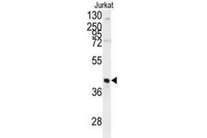 Image no. 1 for anti-Fructose-1,6-Bisphosphatase 1 (FBP1) (N-Term) antibody (ABIN452993) (FBP1 抗体  (N-Term))