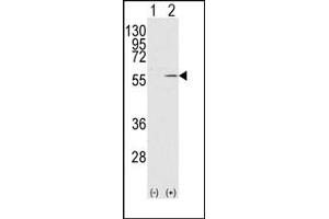 Image no. 1 for anti-Vimentin (VIM) antibody (ABIN357886) (Vimentin 抗体)