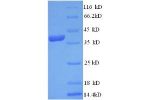 SDS-PAGE (SDS) image for 3-Hydroxy-3-Methylglutaryl-CoA Reductase (HMGCR) (AA 588-887), (partial) protein (His tag) (ABIN5709669)