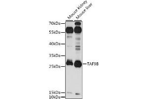 Western blot analysis of extracts of various cell lines, using TB antibody (ABIN7270718) at 1:1000 dilution. (TAF9B 抗体  (AA 50-150))