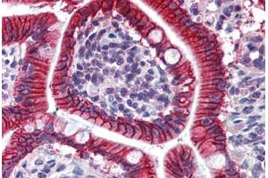 Human Small Intestine: Formalin-Fixed, Paraffin-Embedded (FFPE) (LI Cadherin 抗体  (AA 24-132))