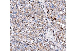 IHC analysis of Paxillin/PXN using anti-Paxillin/PXN antibody (ABIN7602636). (Paxillin 抗体  (AA 9-570))