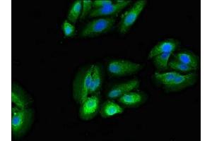 Immunofluorescent analysis of HepG2 cells using ABIN7142563 at dilution of 1:100 and Alexa Fluor 488-congugated AffiniPure Goat Anti-Rabbit IgG(H+L) (RPS5 抗体  (AA 1-204))