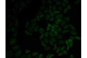 Immunofluorescence analysis of HeLa cells using MSN antibody. (Moesin 抗体  (AA 1-300))