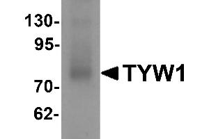 Western blot analysis of TYW1 in human lung tissue lysate with TYW1 antibody at 1 µg/mL. (TYW1 抗体  (C-Term))