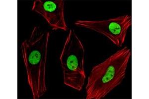 Fluorescent image of SH-SY5Y cells stained with SUMO2/3 antibody diluted at 1:100 dilution. (SUMO2/3 抗体  (AA 49-81))