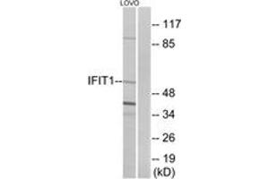 Western Blotting (WB) image for anti-Interferon-Induced Protein with Tetratricopeptide Repeats 1 (IFIT1) (AA 41-90) antibody (ABIN2889970) (IFIT1 抗体  (AA 41-90))