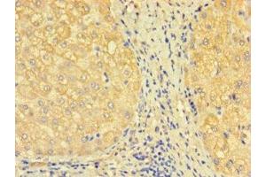 Immunohistochemistry of paraffin-embedded human liver tissue using ABIN7171277 at dilution of 1:100 (SDCBP2 抗体  (AA 11-207))