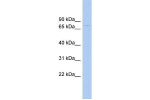WB Suggested Anti-RAD17 Antibody Titration: 0. (RAD17 抗体  (N-Term))