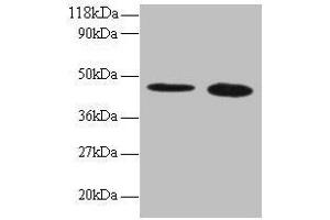 Western blot All lanes: TTC1 antibody at 2 μg/mL Lane 1: 293T whole cell lysate Lane 2: EC109 whole cell lysate Secondary Goat polyclonal to rabbit IgG at 1/15000 dilution Predicted band size: 34 kDa Observed band size: 45 kDa (TTC1 抗体  (AA 3-292))