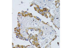 Immunohistochemistry (IHC) image for anti-Acyl-CoA Dehydrogenase, Long Chain (ACADL) (AA 31-210) antibody (ABIN1678519)