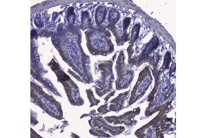 IHC analysis of Cytokeratin 19 using anti-Cytokeratin 19 antibody (ABIN3043288). (Cytokeratin 19 抗体  (C-Term))