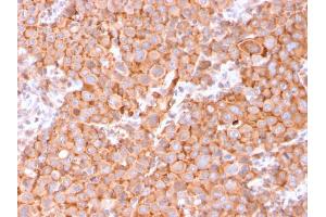 Immunohistochemistry (IHC) image for anti-Uroplakin 1B (UPK1B) (AA 109-229) antibody (ABIN6940857)