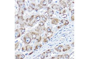 Immunohistochemistry of paraffin-embedded human liver using AGXT Rabbit pAb  at dilution of 1:150 (40x lens). (AGXT 抗体  (AA 183-392))