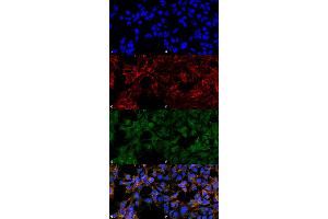 Immunocytochemistry/Immunofluorescence analysis using Mouse Anti-Malondialdehyde Monoclonal Antibody, Clone 6H6 . (Malondialdehyde 抗体  (FITC))