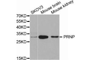 Western blot analysis of extracts of various cell lines, using PRNP antibody. (PRNP 抗体  (AA 23-230))