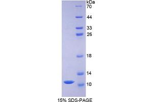 SDS-PAGE analysis of Pig Defensin beta 1 Protein. (beta Defensin 1 蛋白)
