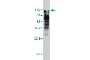 Western Blot detection against Immunogen (123. (MVP 抗体  (AA 1-893))