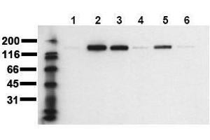 Western Blotting (WB) image for anti-Receptor tyrosine-protein kinase erbB-2 (ErbB2/Her2) (pThr686) antibody (ABIN126787) (ErbB2/Her2 抗体  (pThr686))