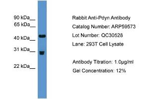 WB Suggested Anti-Pdyn  Antibody Titration: 0. (PDYN 抗体  (Middle Region))
