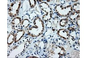 Immunohistochemical staining of paraffin-embedded Kidney tissue using anti-PLEK mouse monoclonal antibody. (Pleckstrin 抗体)