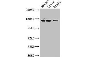 Western Blot Positive WB detected in: HEK293 whole cell lysate, Mouse liver tissue, Mouse brain tissue All lanes: GUCY2C antibody at 3. (GUCY2C 抗体  (AA 636-891))