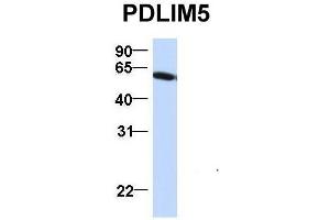 Host:  Rabbit  Target Name:  PDLIM5  Sample Type:  HepG2  Antibody Dilution:  1.