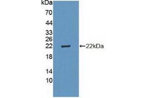 Detection of Recombinant CDKN2D, Human using Polyclonal Antibody to Cyclin Dependent Kinase Inhibitor 2D (CDKN2D) (CDKN2D 抗体  (AA 1-166))