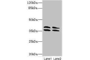 Western blot All lanes: CA10 antibody at 4 μg/mL Lane 1: HL60 whole cell lysate Lane 2: Mouse brain tissue Secondary Goat polyclonal to rabbit IgG at 1/10000 dilution Predicted band size: 38, 30 kDa Observed band size: 38 kDa (CA1 抗体  (AA 61-320))