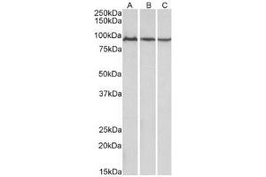AP21267PU-N ACO2 Antibody staining of Mouse (A), Rat (B) and Pig (C) Skeletal Muscle lysates at 0. (ACO2 抗体  (Internal Region))