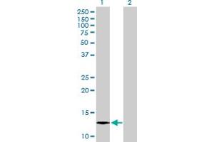 Western Blot analysis of C1orf38 expression in transfected 293T cell line by C1orf38 MaxPab polyclonal antibody. (C1orf38 抗体  (AA 1-132))